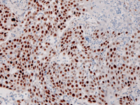 anti-p53 (Bp53-11) Primary Antibody