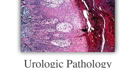 Pathology Laboratory Dermatopathology Research In Tampa Bay Our Services